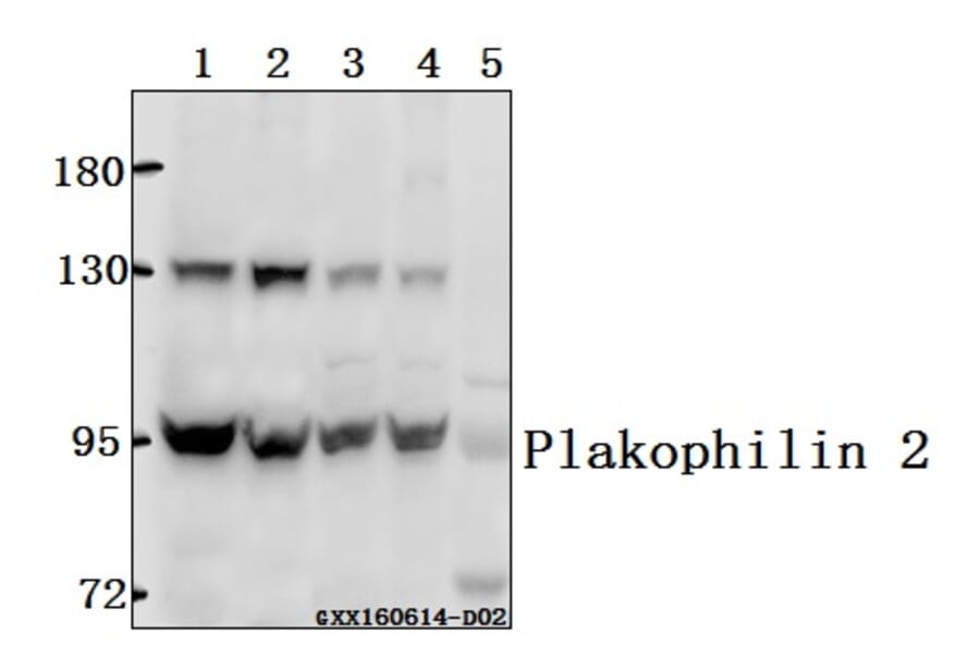 Anti-Plakophilin 2 (P663) Antibody from Bioworld Technology (BS3368) - Antibodies.com
