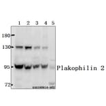 Anti-Plakophilin 2 (P663) Antibody from Bioworld Technology (BS3368) - Antibodies.com