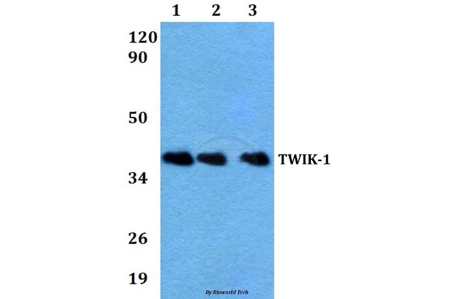 Anti-TWIK-1 (V322) Antibody from Bioworld Technology (BS3370) - Antibodies.com