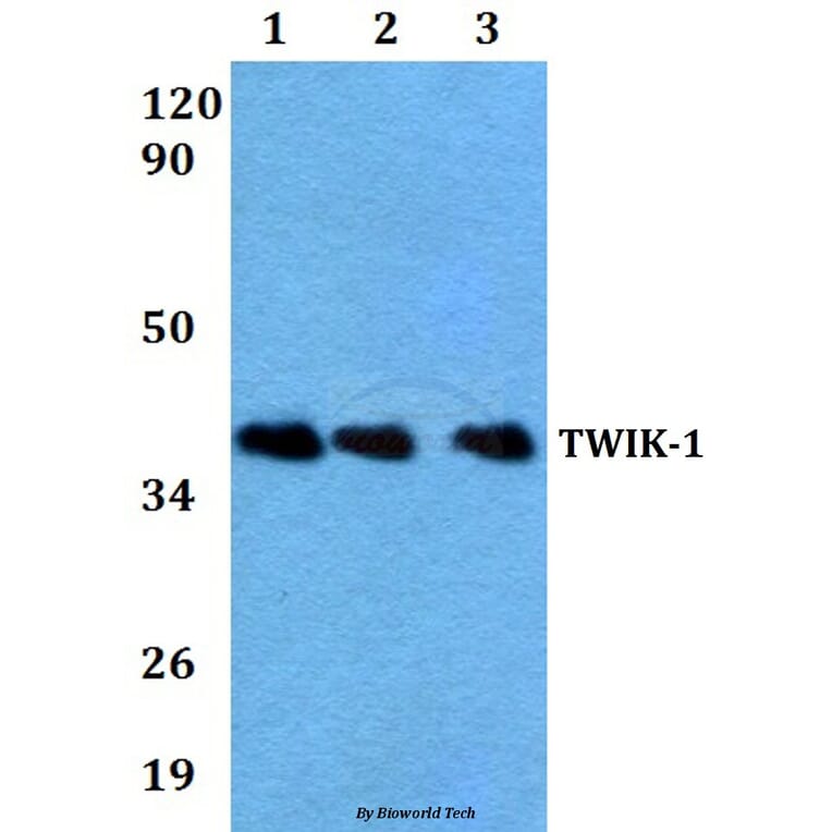 Anti-TWIK-1 (V322) Antibody from Bioworld Technology (BS3370) - Antibodies.com