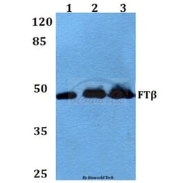 Anti-FTβ (E285) Antibody from Bioworld Technology (BS3377) - Antibodies.com