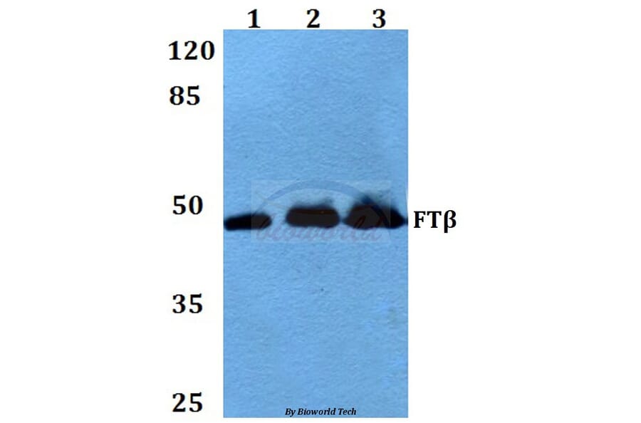 Anti-FTβ (E285) Antibody from Bioworld Technology (BS3377) - Antibodies.com