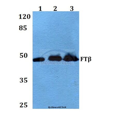 Anti-FTβ (E285) Antibody from Bioworld Technology (BS3377) - Antibodies.com