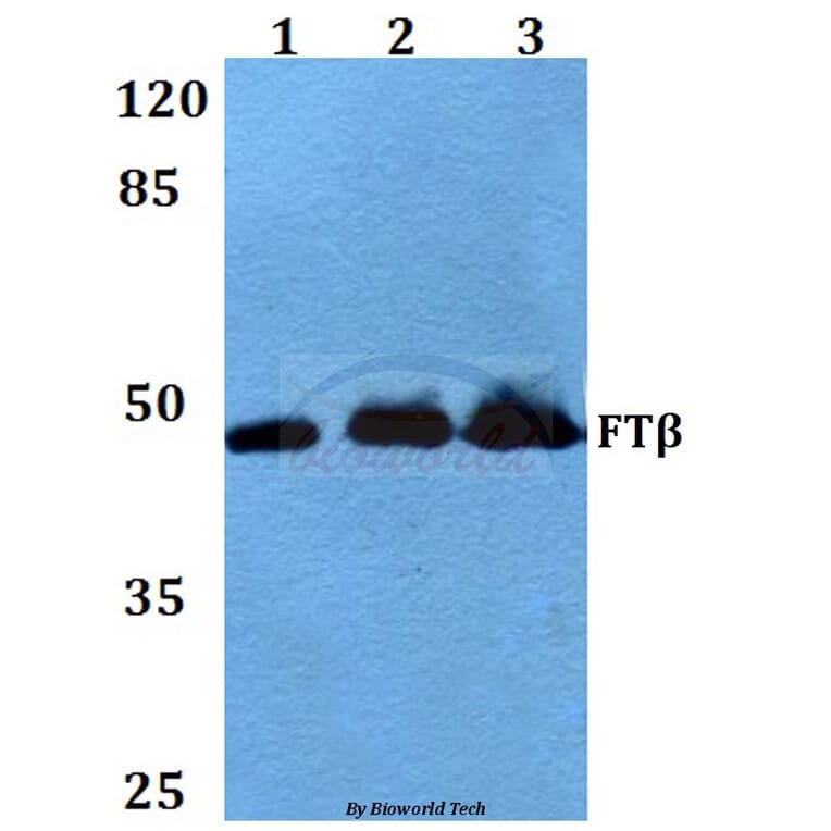 Anti-FTβ (E285) Antibody from Bioworld Technology (BS3377) - Antibodies.com