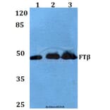 Anti-FTβ (E285) Antibody from Bioworld Technology (BS3377) - Antibodies.com