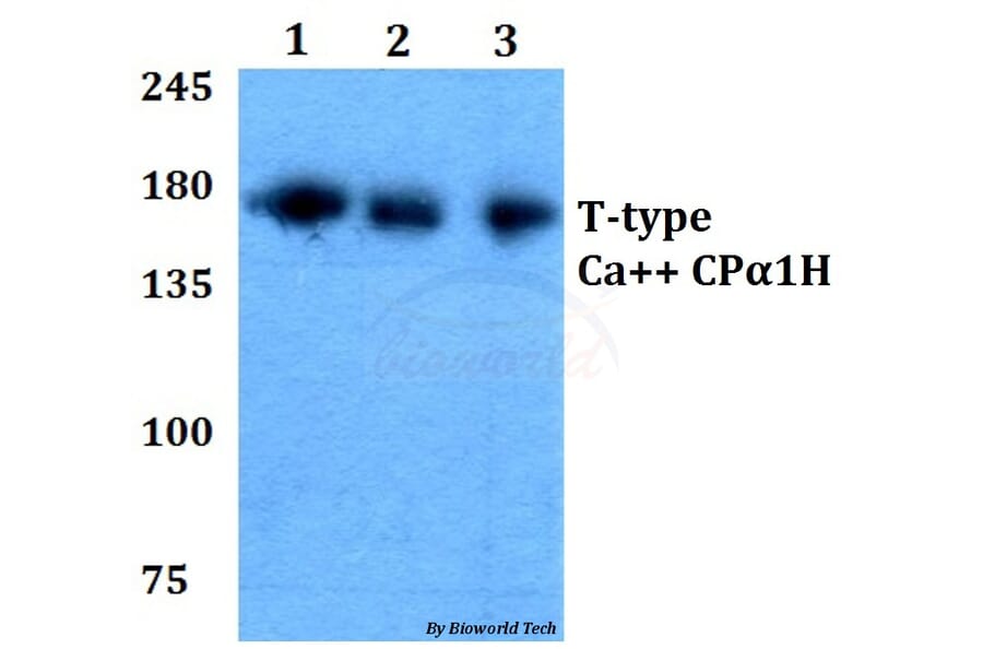 Anti-T-type Ca++ CP α1H (P492) Antibody from Bioworld Technology (BS3413) - Antibodies.com