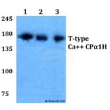 Anti-T-type Ca++ CP α1H (P492) Antibody from Bioworld Technology (BS3413) - Antibodies.com