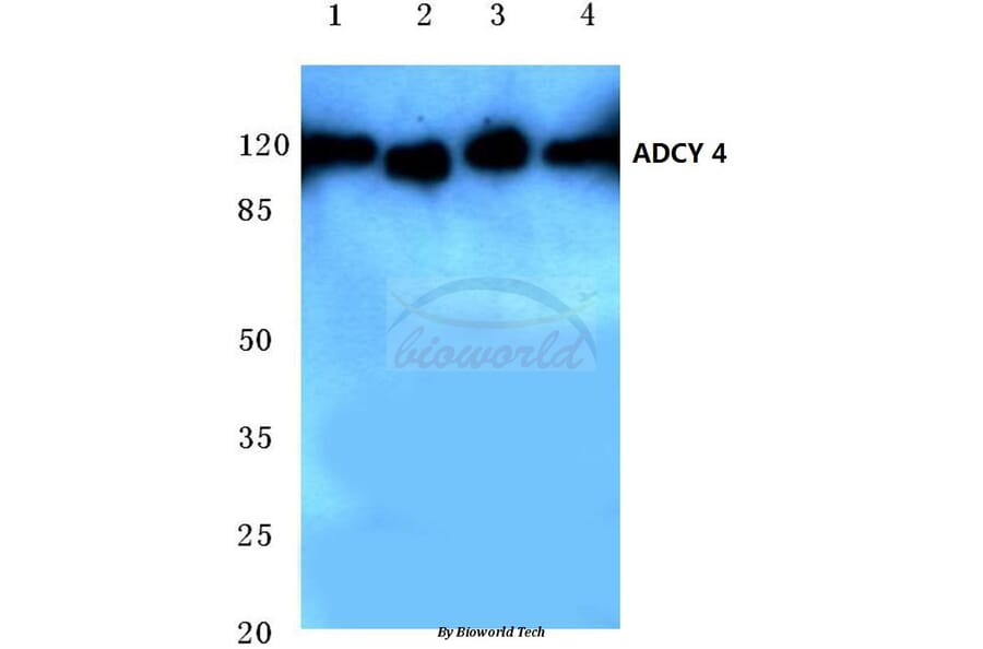 Anti-ADCY 4 (L226) Antibody from Bioworld Technology (BS3421) - Antibodies.com