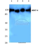 Anti-ADCY 4 (L226) Antibody from Bioworld Technology (BS3421) - Antibodies.com