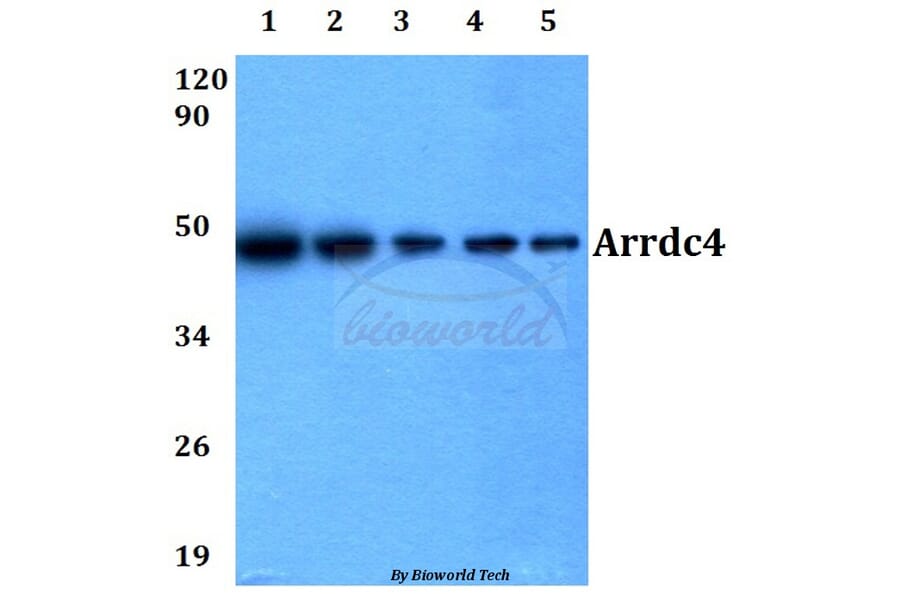 Anti-Arrdc4 (E159) Antibody from Bioworld Technology (BS3423) - Antibodies.com