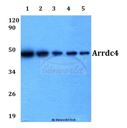 Anti-Arrdc4 (E159) Antibody from Bioworld Technology (BS3423) - Antibodies.com