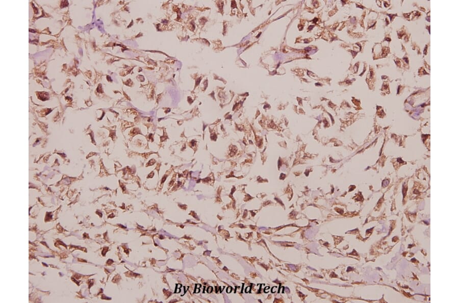 Anti-Arrdc4 (E159) Antibody from Bioworld Technology (BS3423) - Antibodies.com