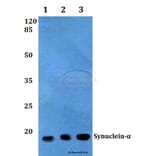 Anti-Synuclein-α (D119) Antibody from Bioworld Technology (BS3429) - Antibodies.com