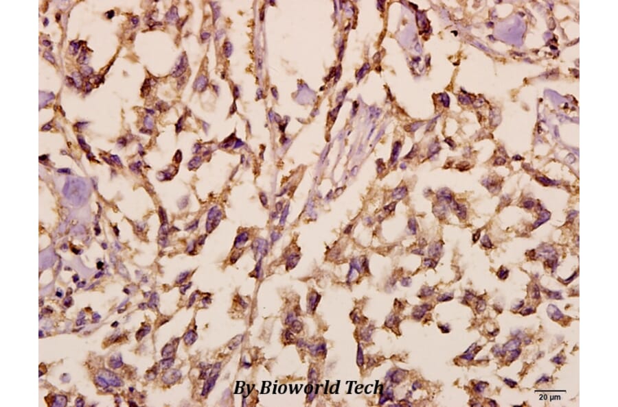 Anti-Synuclein-α (D119) Antibody from Bioworld Technology (BS3429) - Antibodies.com