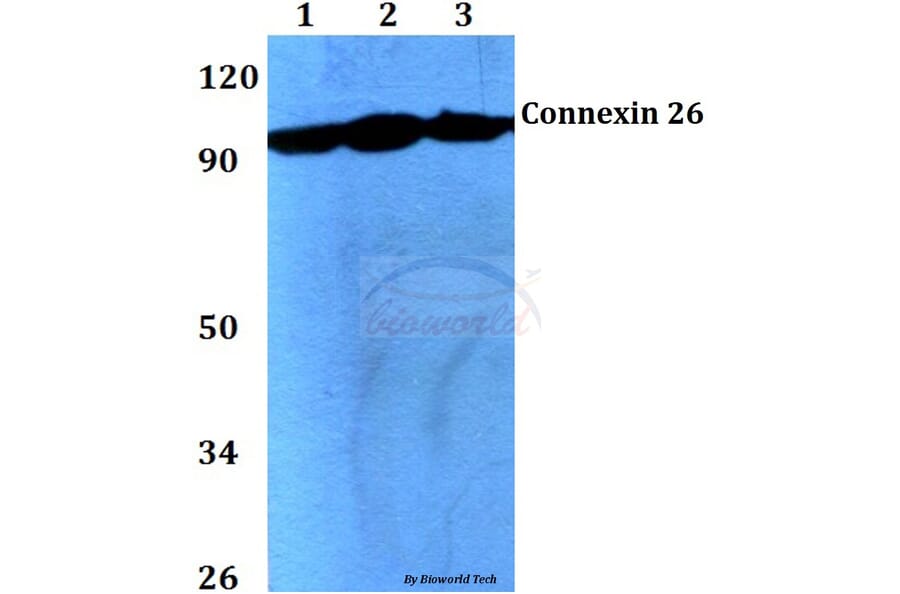 Anti-mGluR-2/3 (N867) Antibody from Bioworld Technology (BS3430) - Antibodies.com