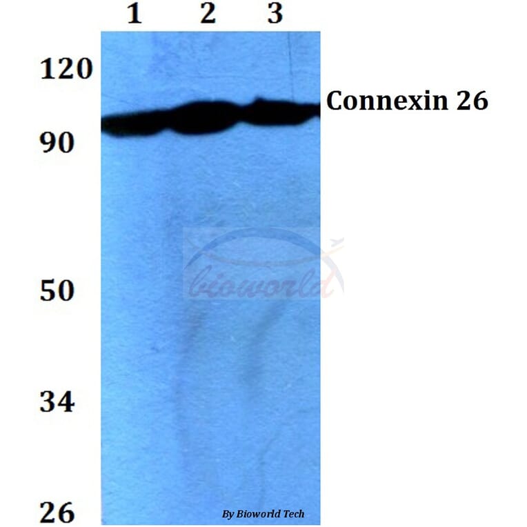 Anti-mGluR-2/3 (N867) Antibody from Bioworld Technology (BS3430) - Antibodies.com