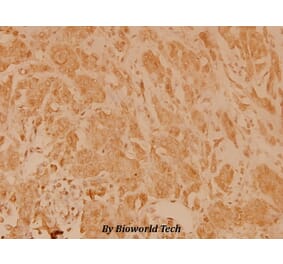 Anti-eIF4E (T203) Antibody from Bioworld Technology (BS3432) - Antibodies.com
