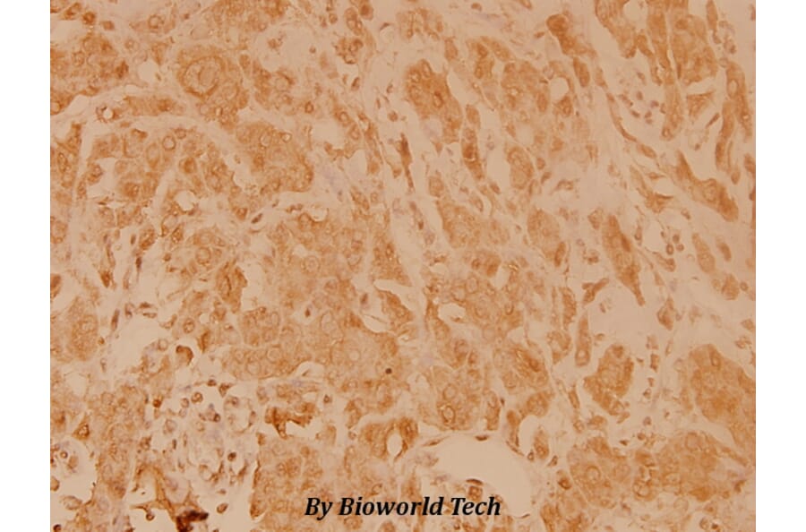 Anti-eIF4E (T203) Antibody from Bioworld Technology (BS3432) - Antibodies.com