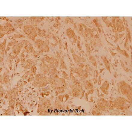 Anti-eIF4E (T203) Antibody from Bioworld Technology (BS3432) - Antibodies.com