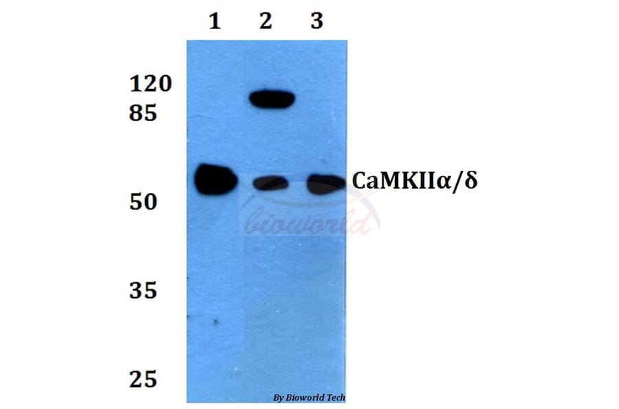 Anti-CaMKIIα/δ (M281) Antibody from Bioworld Technology (BS3433) - Antibodies.com
