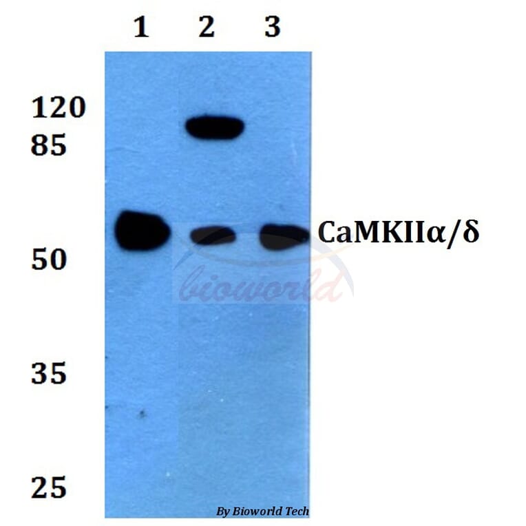 Anti-CaMKIIα/δ (M281) Antibody from Bioworld Technology (BS3433) - Antibodies.com