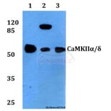 Anti-CaMKIIα/δ (M281) Antibody from Bioworld Technology (BS3433) - Antibodies.com
