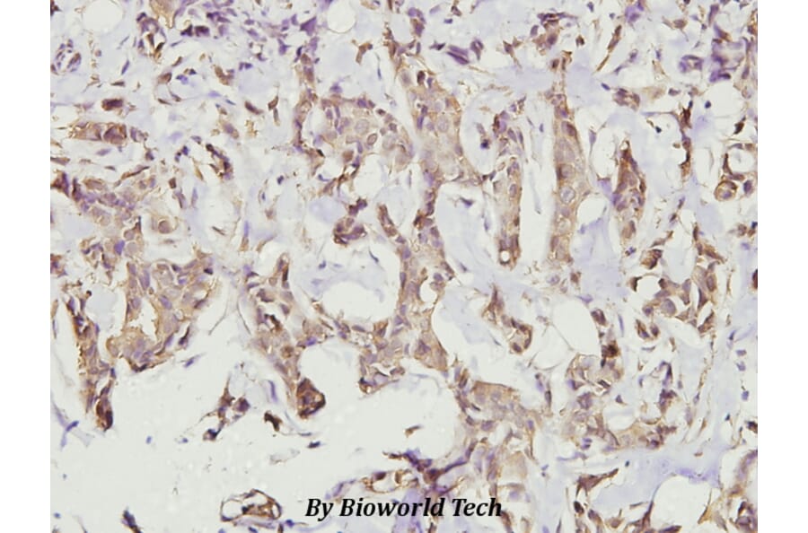 Anti-CaMKIIα/δ (M281) Antibody from Bioworld Technology (BS3433) - Antibodies.com