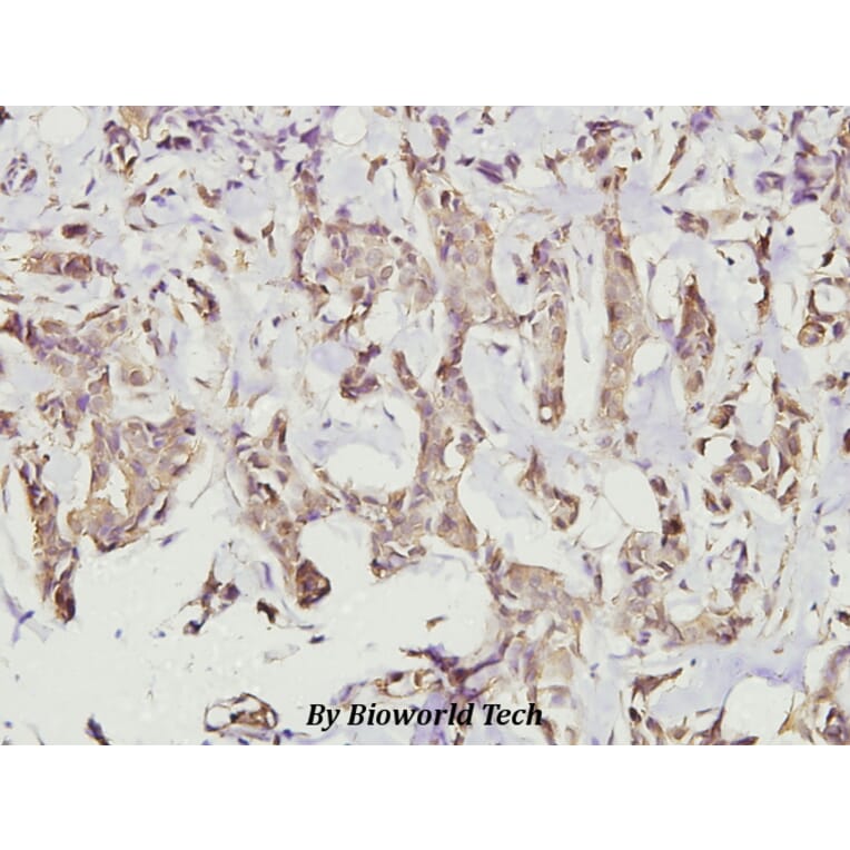 Anti-CaMKIIα/δ (M281) Antibody from Bioworld Technology (BS3433) - Antibodies.com
