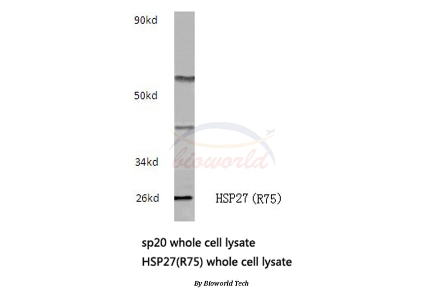 Anti-HSP27 (R75) Antibody from Bioworld Technology (BS3435) - Antibodies.com