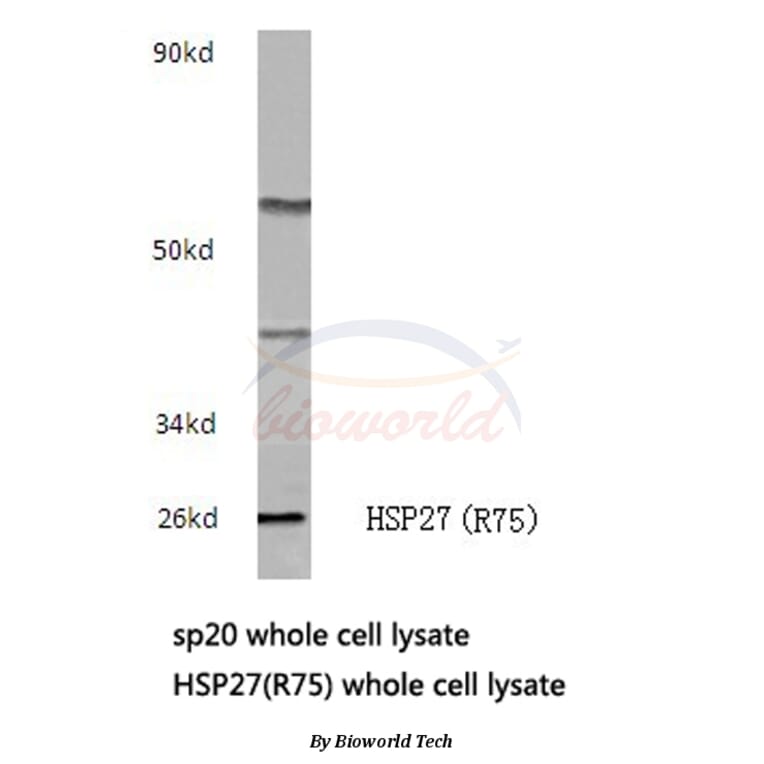 Anti-HSP27 (R75) Antibody from Bioworld Technology (BS3435) - Antibodies.com