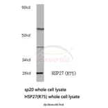 Anti-HSP27 (R75) Antibody from Bioworld Technology (BS3435) - Antibodies.com
