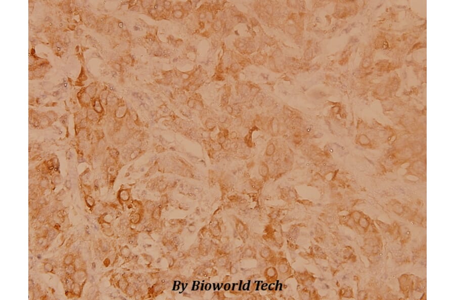 Anti-HSP27 (R75) Antibody from Bioworld Technology (BS3435) - Antibodies.com