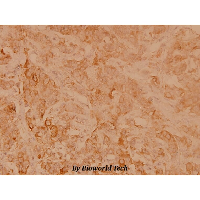 Anti-HSP27 (R75) Antibody from Bioworld Technology (BS3435) - Antibodies.com