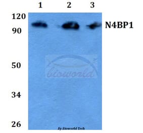 Anti-CA II (N229) Antibody from Bioworld Technology (BS3440) - Antibodies.com