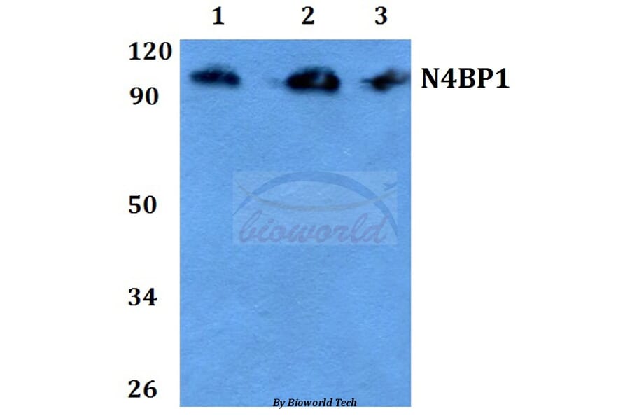 Anti-CA II (N229) Antibody from Bioworld Technology (BS3440) - Antibodies.com
