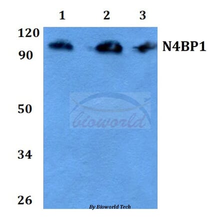 Anti-CA II (N229) Antibody from Bioworld Technology (BS3440) - Antibodies.com