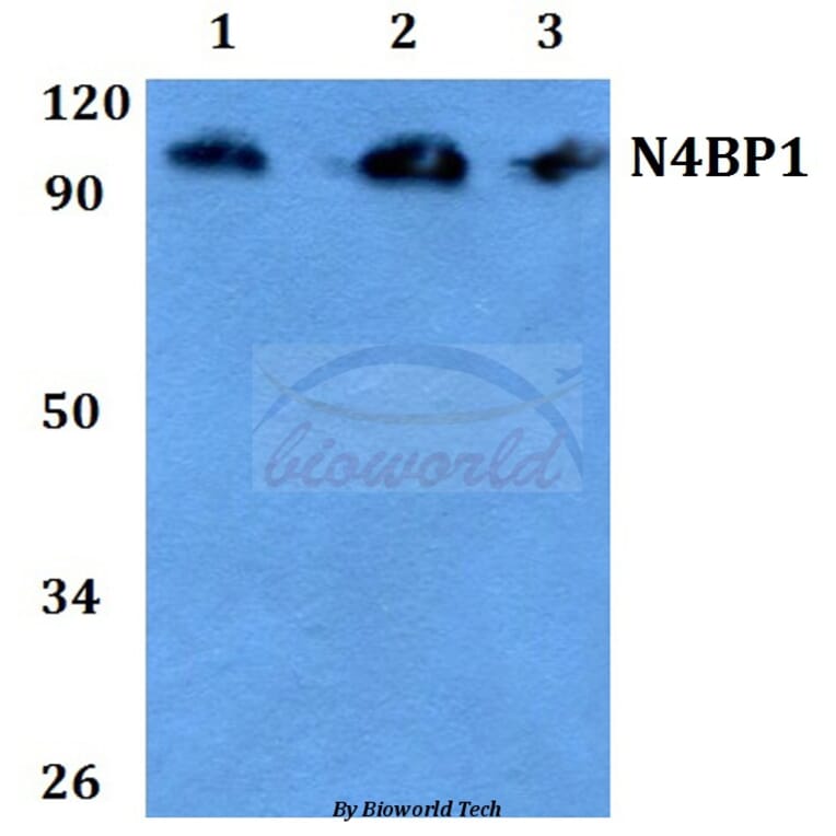 Anti-CA II (N229) Antibody from Bioworld Technology (BS3440) - Antibodies.com