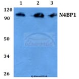 Anti-CA II (N229) Antibody from Bioworld Technology (BS3440) - Antibodies.com