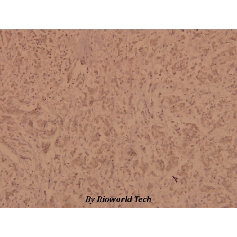 Anti-FucT-IV (E71) Antibody from Bioworld Technology (BS3444) - Antibodies.com