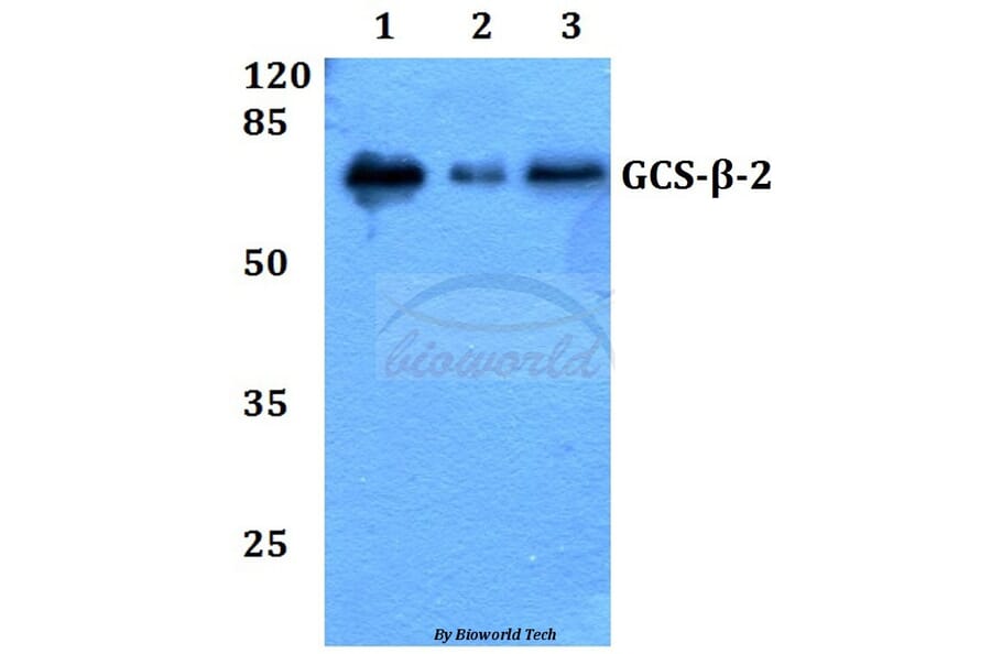 Anti-GCS-β-2 (V102) Antibody from Bioworld Technology (BS3445) - Antibodies.com