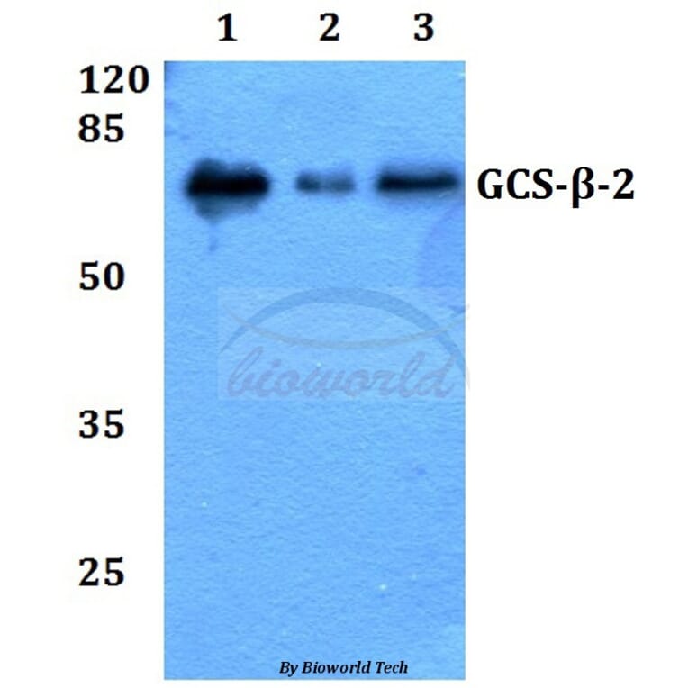 Anti-GCS-β-2 (V102) Antibody from Bioworld Technology (BS3445) - Antibodies.com