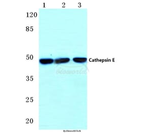 Anti-Cathepsin E (I292) Antibody from Bioworld Technology (BS3446) - Antibodies.com