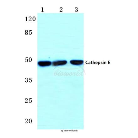 Anti-Cathepsin E (I292) Antibody from Bioworld Technology (BS3446) - Antibodies.com
