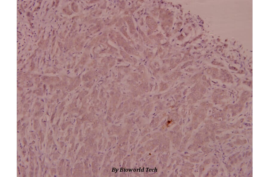 Anti-ADM (N100) Antibody from Bioworld Technology (BS3447) - Antibodies.com