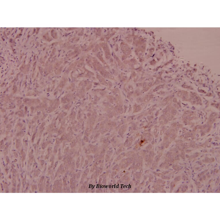 Anti-ADM (N100) Antibody from Bioworld Technology (BS3447) - Antibodies.com