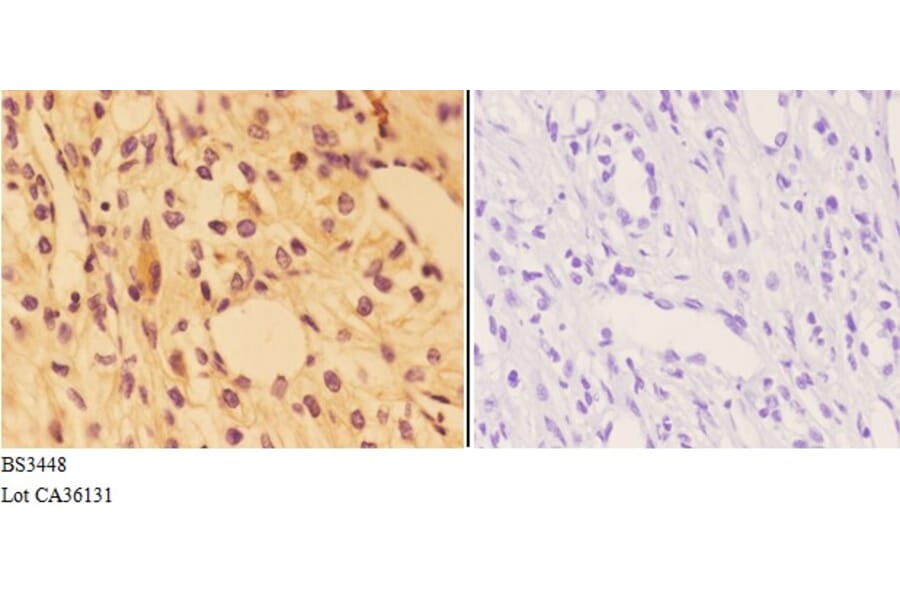 Anti-AGER / RAGE (E182) Antibody from Bioworld Technology (BS3448) - Antibodies.com