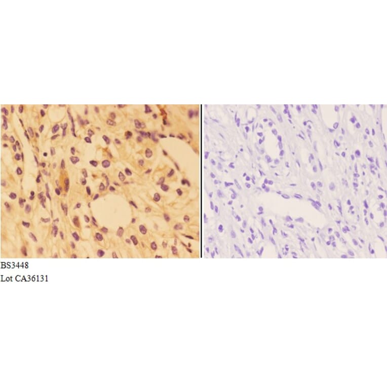 Anti-AGER / RAGE (E182) Antibody from Bioworld Technology (BS3448) - Antibodies.com