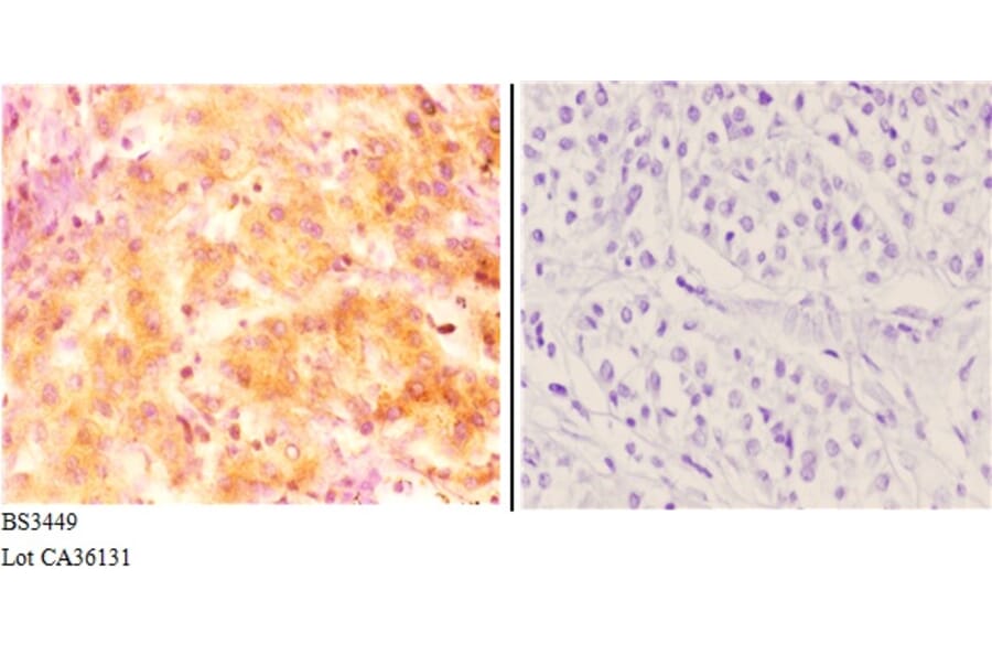 Anti-Inhibin β-C (V129) Antibody from Bioworld Technology (BS3449) - Antibodies.com