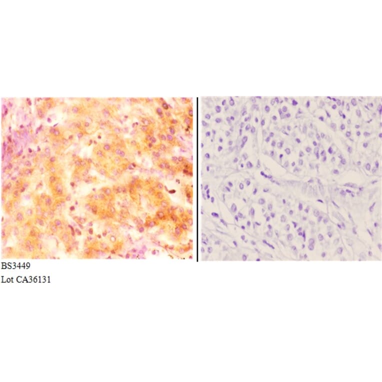 Anti-Inhibin β-C (V129) Antibody from Bioworld Technology (BS3449) - Antibodies.com