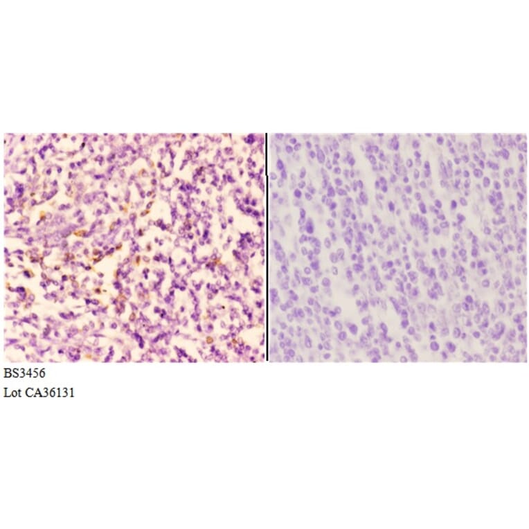Anti-PI3K p110α (R519) Antibody from Bioworld Technology (BS3456) - Antibodies.com